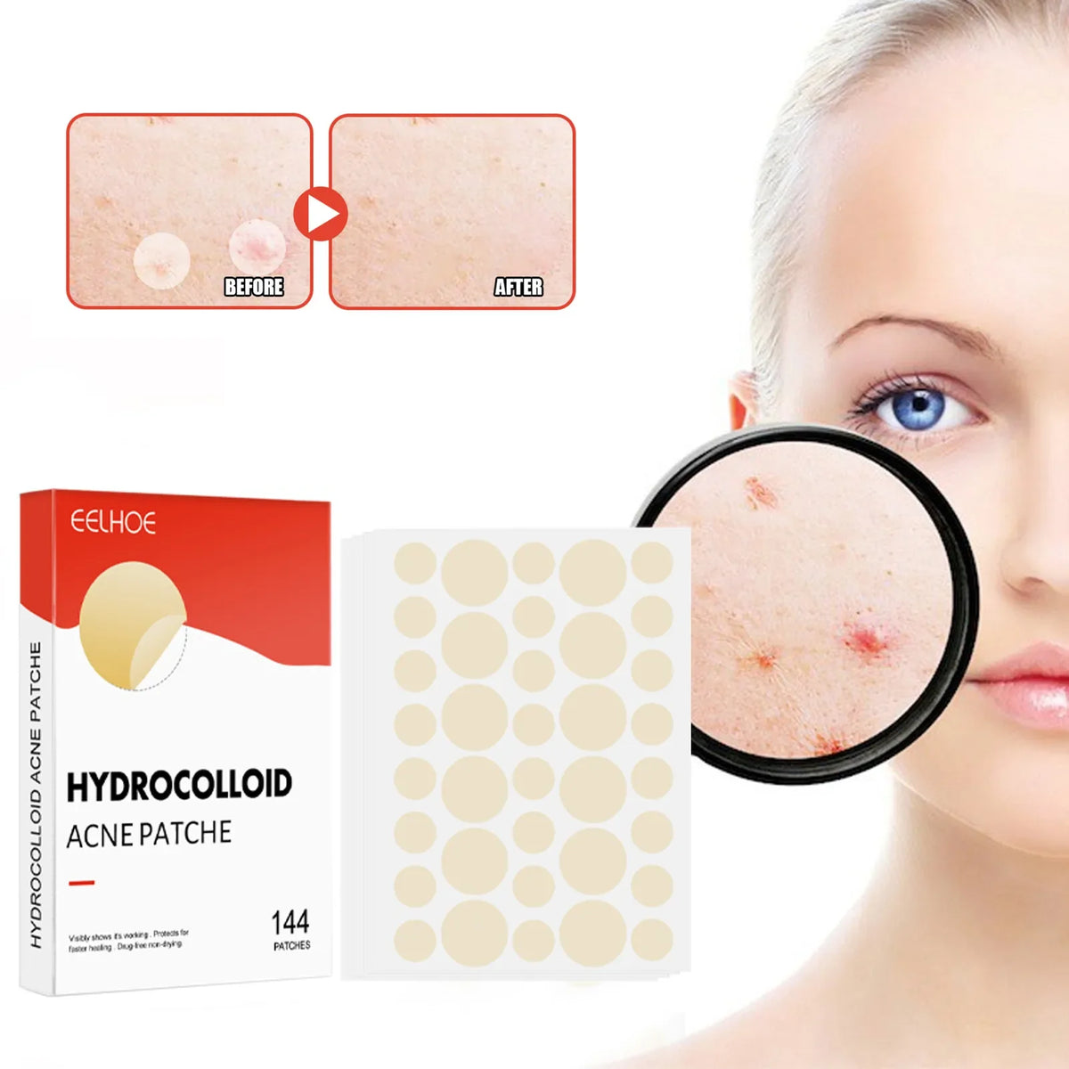 Pimple Patch |Invisible Acne Pimple Patch Stickers