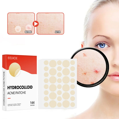 Pimple Patch |Invisible Acne Pimple Patch Stickers